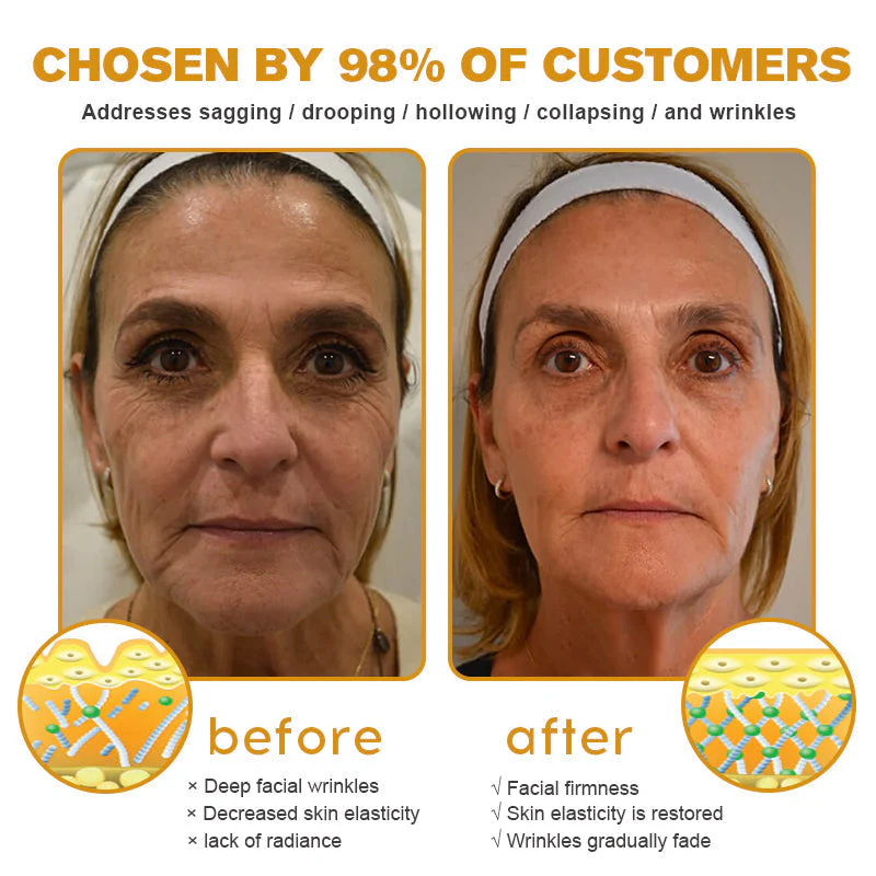 👨‍⚕️ Made and Shipped from US✅ Tlopa® Bee Venom Multi-Symptom Skin Treatment Cream