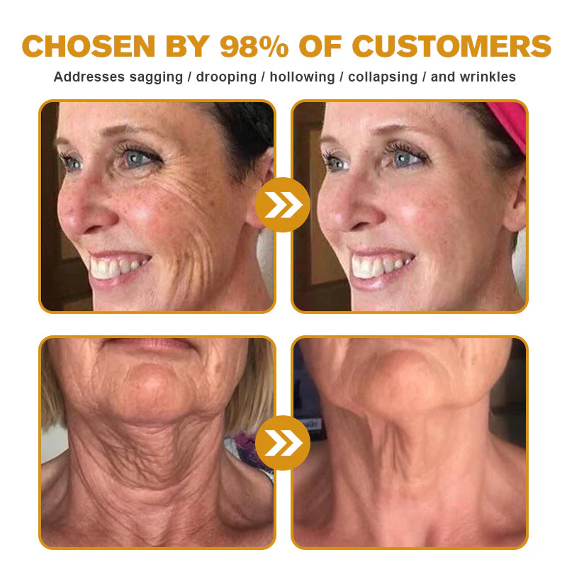 👨‍⚕️ Made and Shipped from US✅ Tlopa® Bee Venom Multi-Symptom Skin Treatment Cream