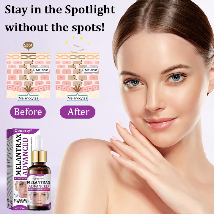 💜MelantraX Advanced Anti-Hyperpigmentation Essence💜