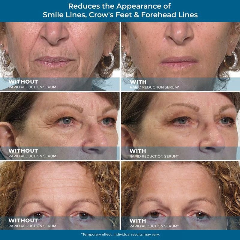 ⏰Last Day Only$19.99🔥 Rapid Reduction Eye Serum – Instant Tightening & Anti-Aging for Eyes & Face ✨