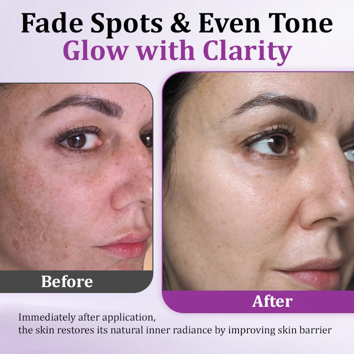 💜MelantraX Advanced Anti-Hyperpigmentation Essence💜