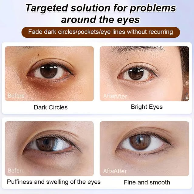 🔥Anti-wrinkle eye serum oil🔥