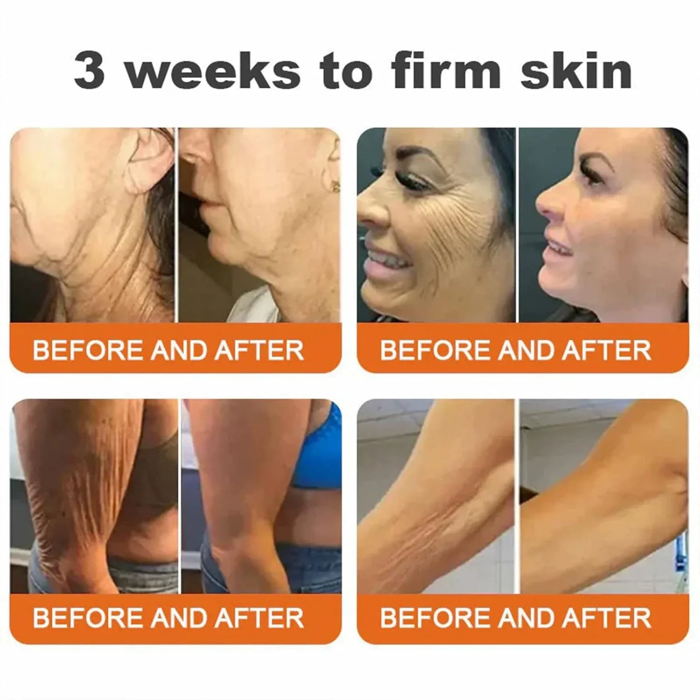 🐝🏅Flysmus™ Botox Bee Venom Firming Serum Stick-(Made and Shipped from Australia)-LAST DAY 70% OFF