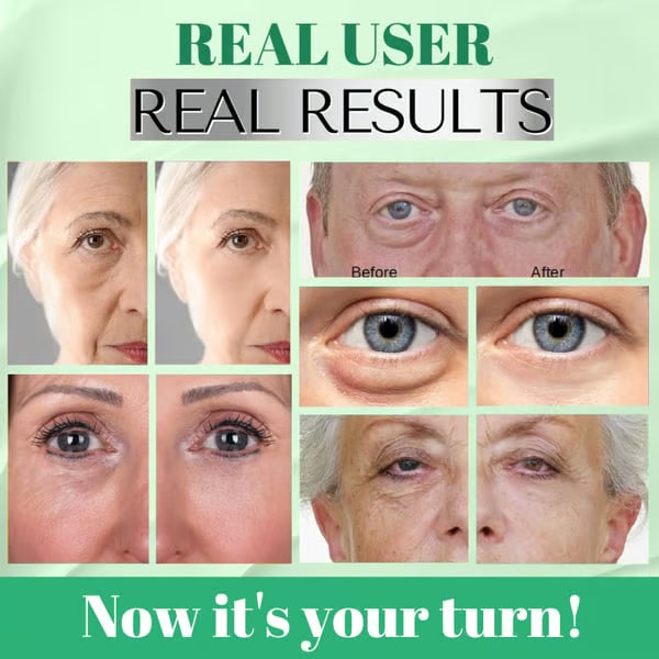CollaVerdes' Collagen Eye Mask™