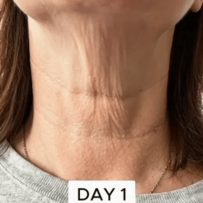 💜Official Authorized |🔥Neck Care Stick, Oil-nourishing, Firming & Lifting Firming Neck Cream