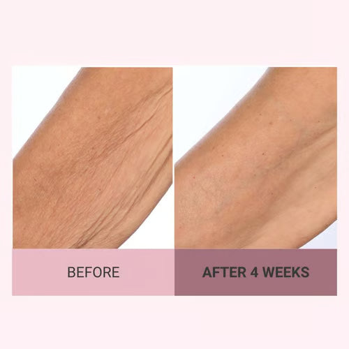 🔥Last day discount 49% off Consult Beaute Champagne Beaute Lifting and Firming Body Cream