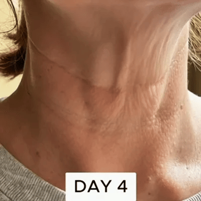 💜Official Authorized |🔥Neck Care Stick, Oil-nourishing, Firming & Lifting Firming Neck Cream