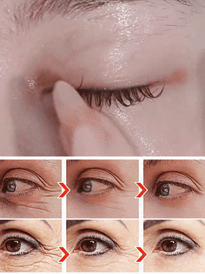 🔥Anti-wrinkle eye serum oil🔥