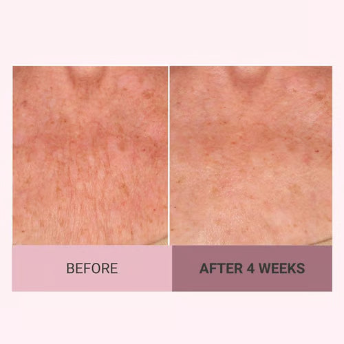 🔥Last day discount 49% off Consult Beaute Champagne Beaute Lifting and Firming Body Cream