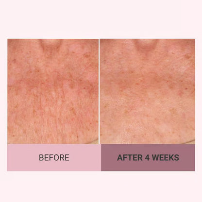 🔥Last day discount 49% off Consult Beaute Champagne Beaute Lifting and Firming Body Cream