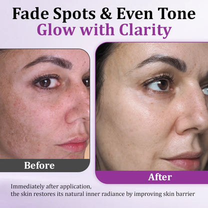 💜MelantraX Advanced Anti-Hyperpigmentation Essence💜