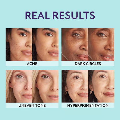 All-in-one moisturizer, concealer & coverage✨