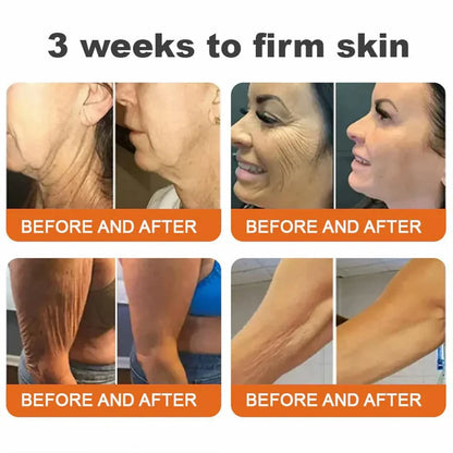 🐝🏅Flysmus™ Botox Bee Venom Firming Serum Stick-(Made and Shipped from Australia)-LAST DAY 70% OFF
