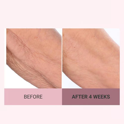 🔥Last day discount 49% off Consult Beaute Champagne Beaute Lifting and Firming Body Cream