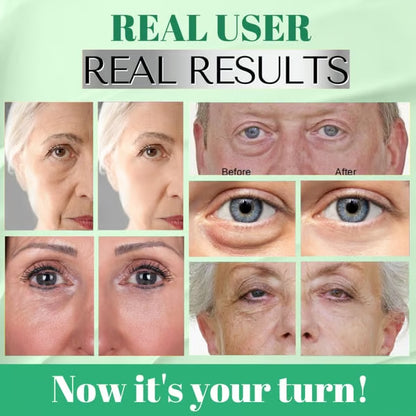 CollaVerdes' Collagen Eye Mask™