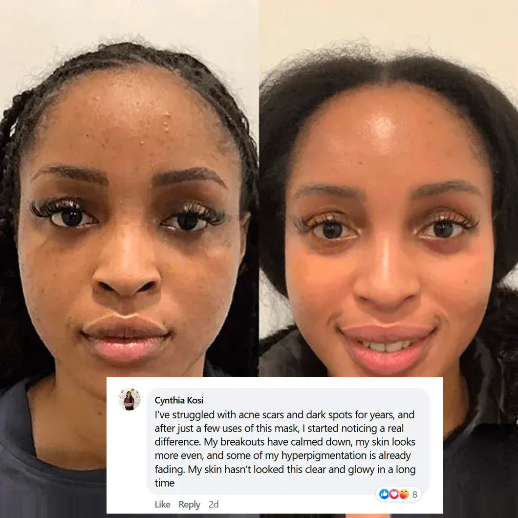 Pamper Yourself — Buy 2 Collagen Night Masks, Get 1 Free! Wake Up to Youthful, Hydrated Skin!